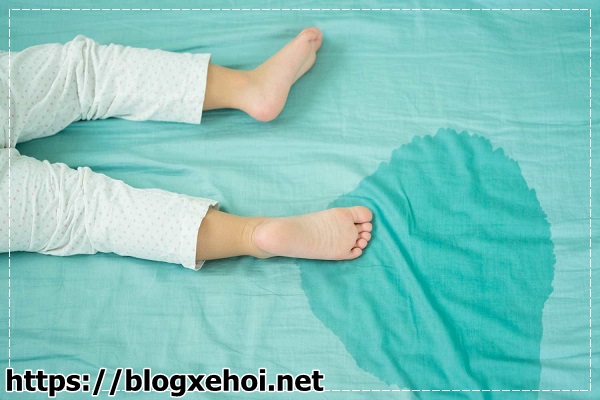 Những nguy&ecirc;n nh&acirc;n khiến bạn t&igrave;m c&aacute;ch khử m&ugrave;i khai nước tiểu